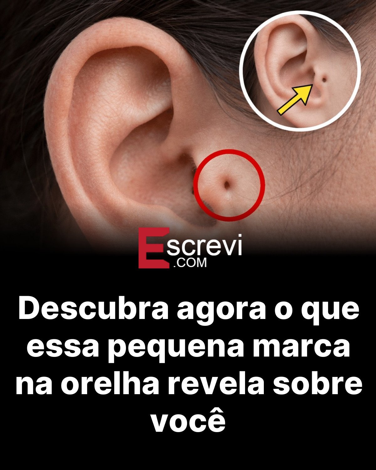 Descubra agora o que essa pequena marca na orelha revela sobre você card preto
