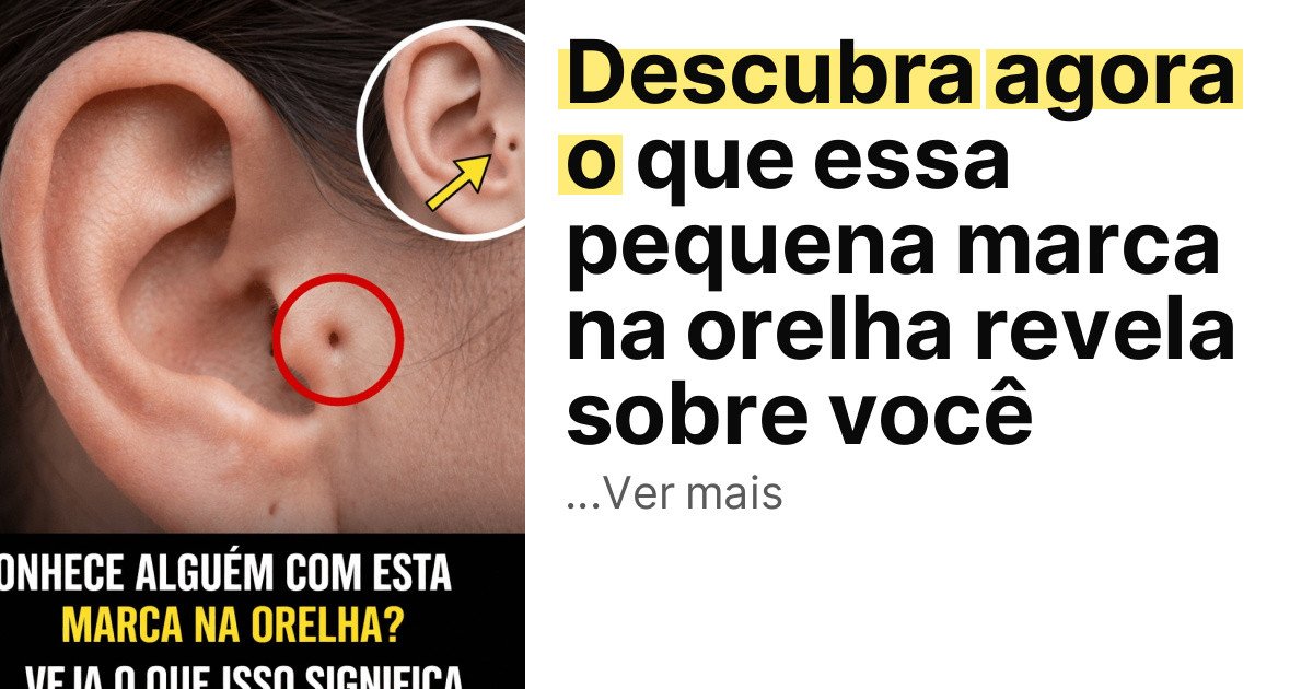Descubra agora o que essa pequena marca na orelha revela sobre você imagem principal