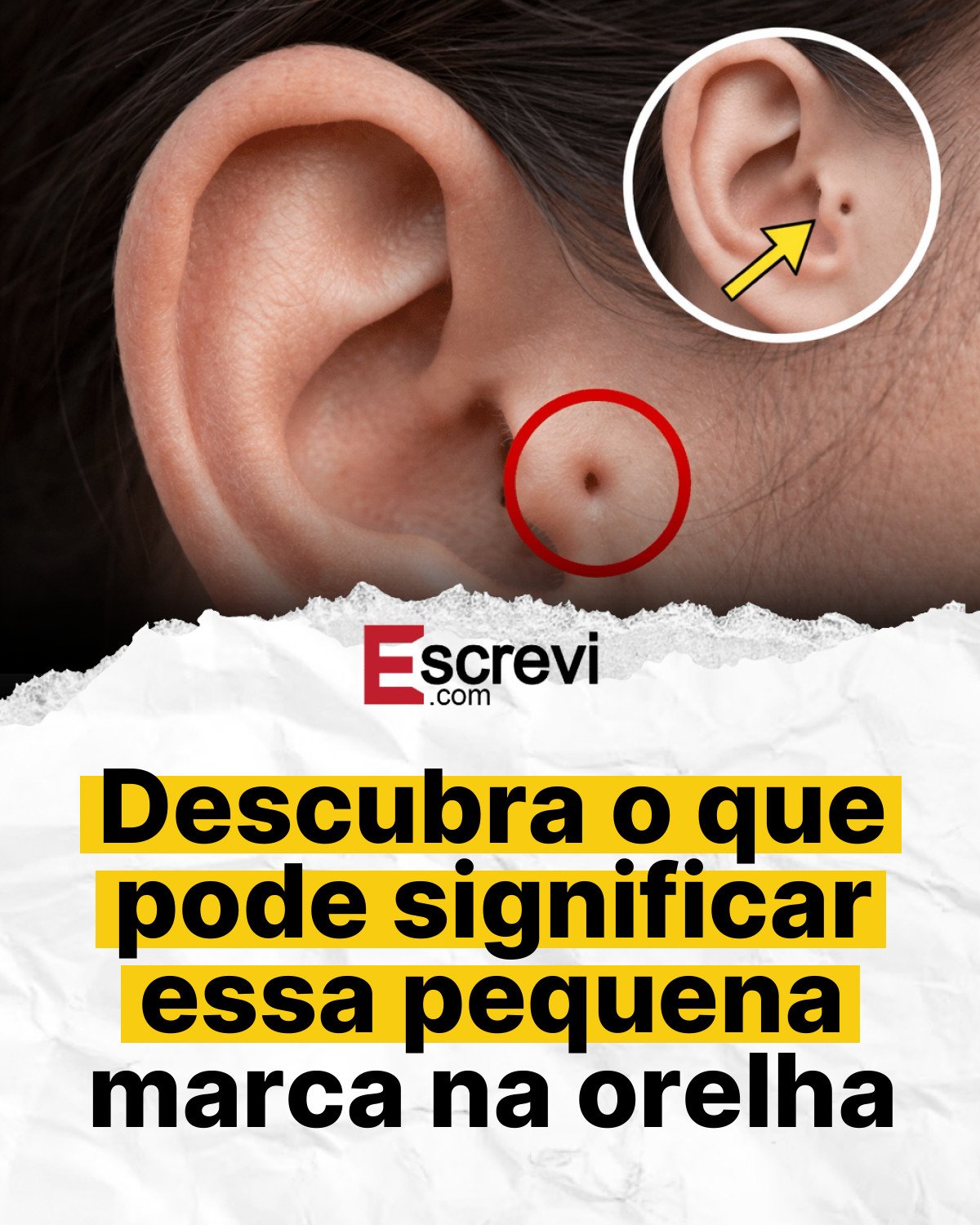 Descubra o que pode significar essa pequena marca na orelha card branco