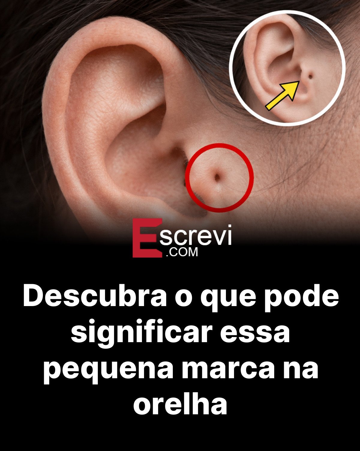 Descubra o que pode significar essa pequena marca na orelha card preto