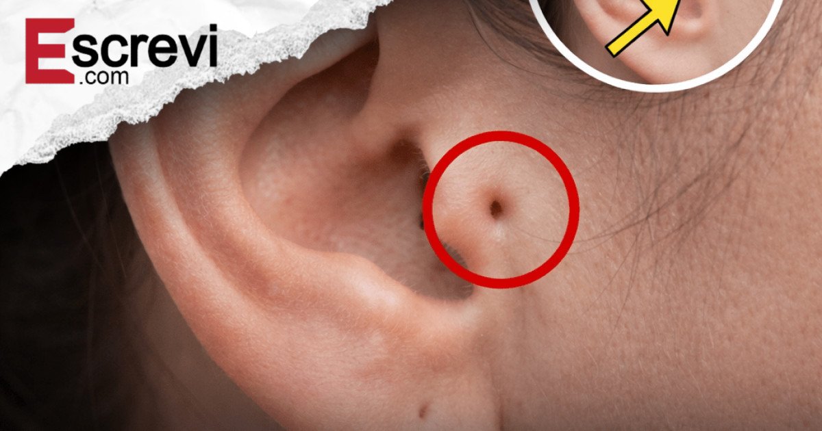 Descubra o que pode significar essa pequena marca na orelha imagem principal