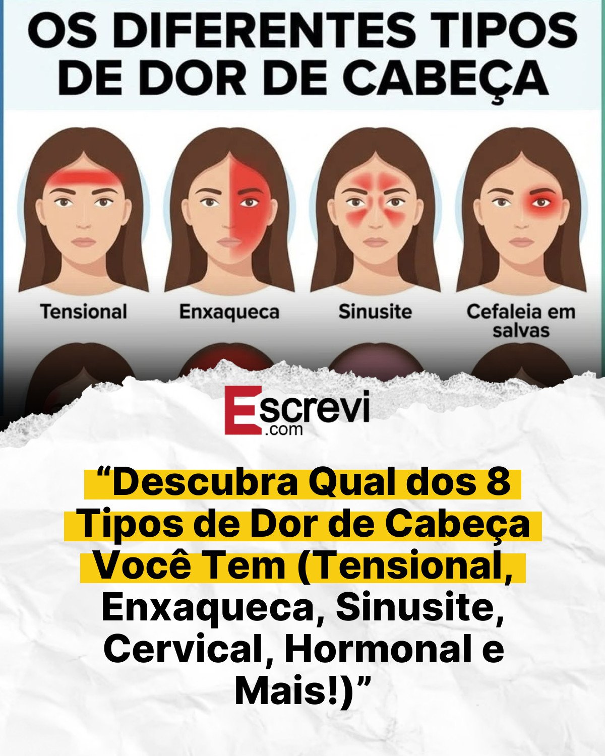 “Descubra Qual dos 8 Tipos de Dor de Cabeça Você Tem (Tensional, Enxaqueca, Sinusite, Cervical, Hormonal e Mais!)” card branco