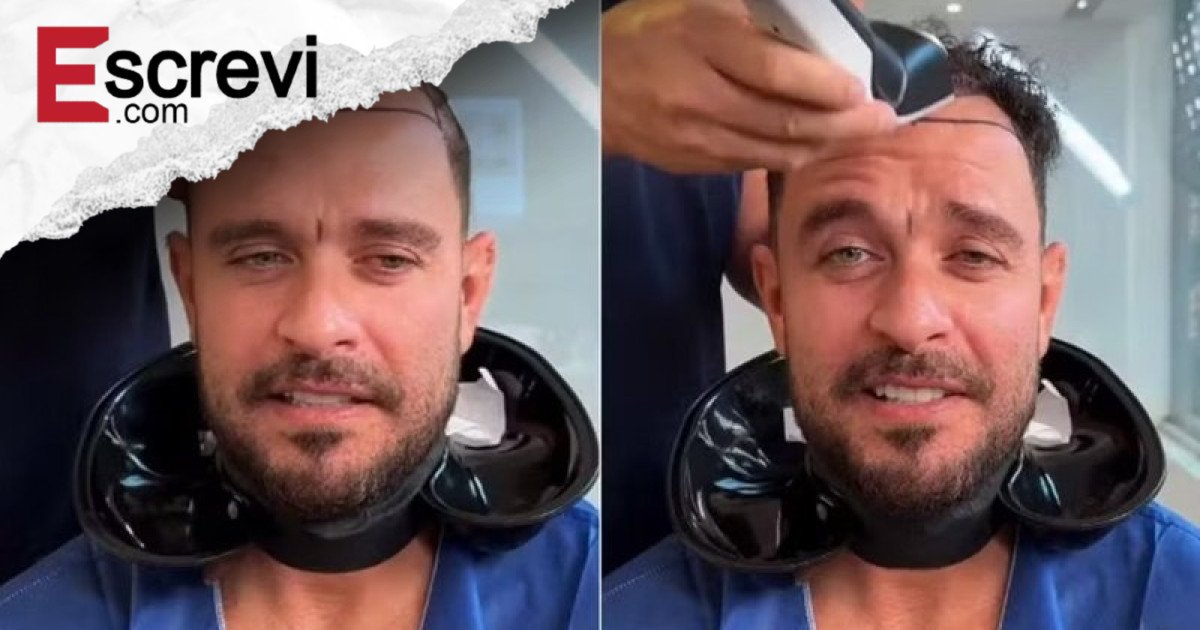 Diogo Nogueira passa por transplante capilar e surpreende com novo visual imagem principal