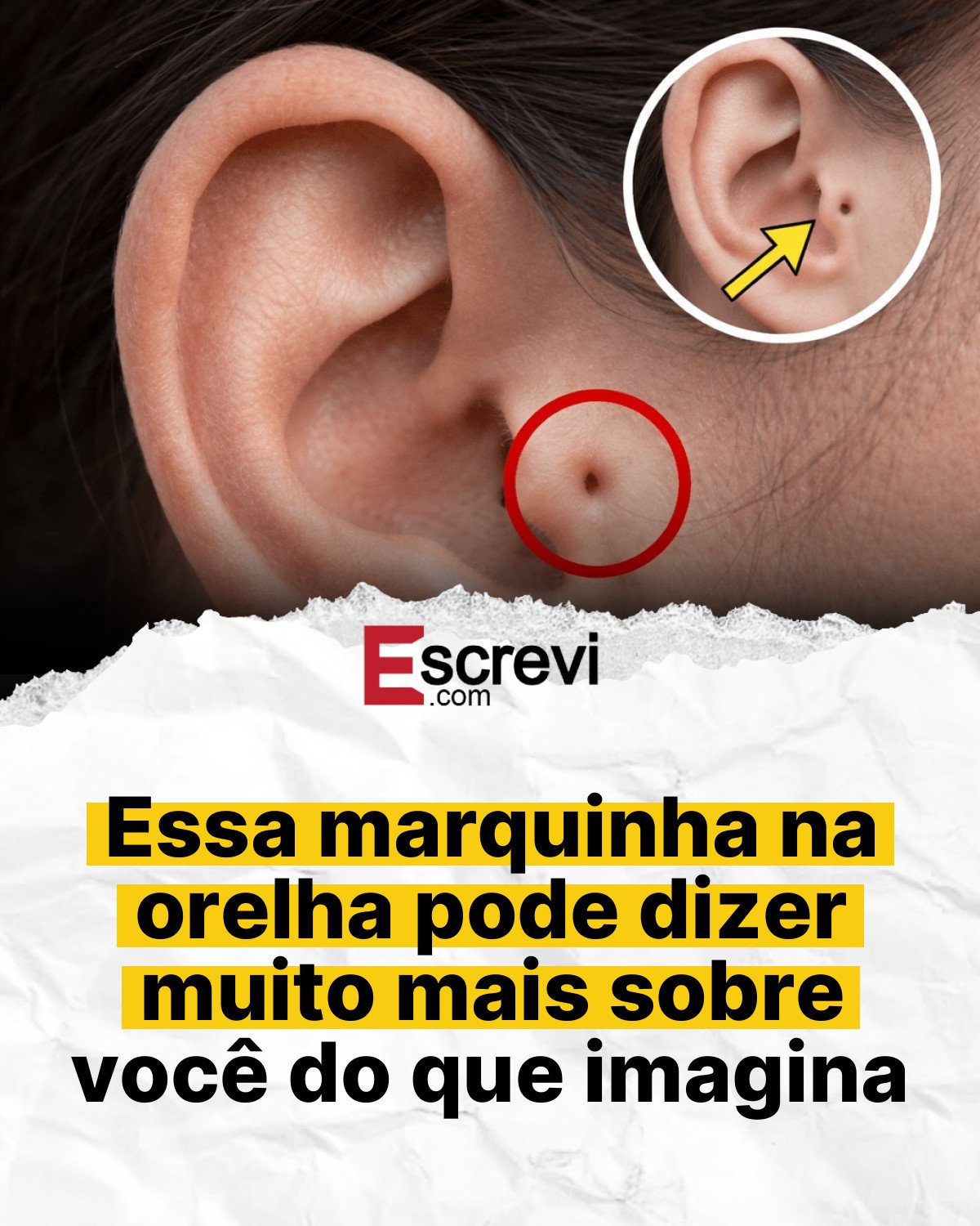 Essa marquinha na orelha pode dizer muito mais sobre você do que imagina card branco