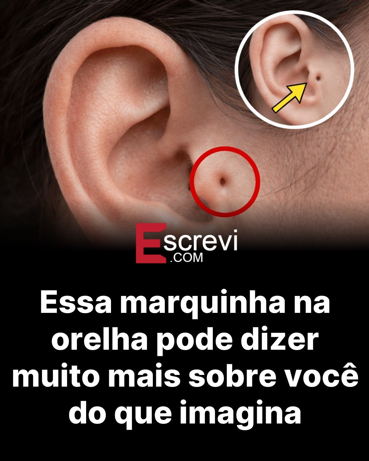 Essa marquinha na orelha pode dizer muito mais sobre você do que imagina card preto