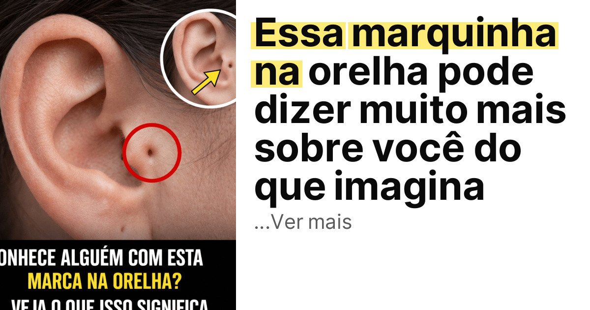 Essa marquinha na orelha pode dizer muito mais sobre você do que imagina imagem principal