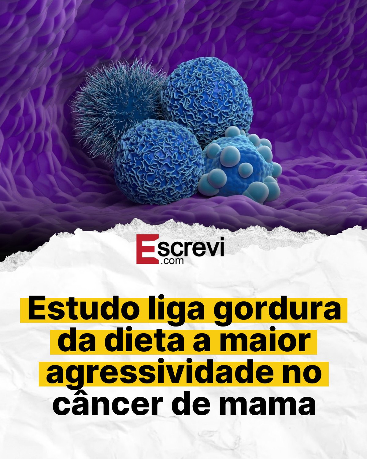 Estudo liga gordura da dieta a maior agressividade no câncer de mama card branco