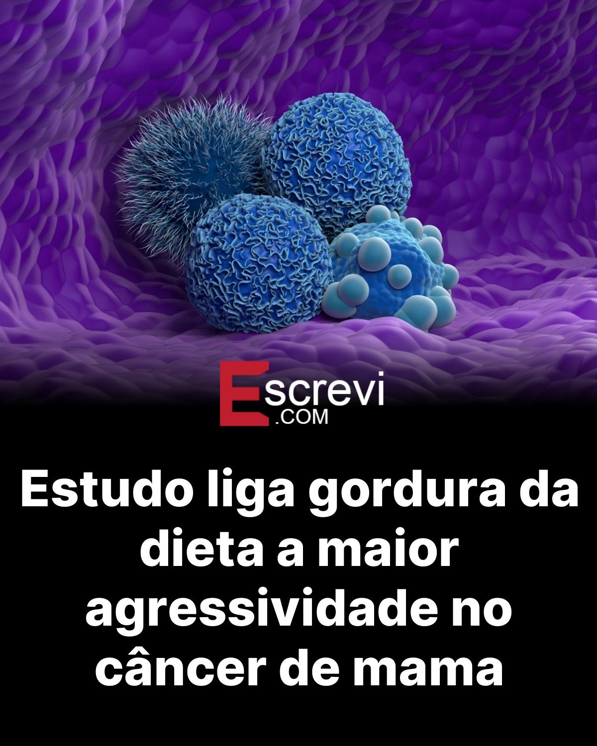 Estudo liga gordura da dieta a maior agressividade no câncer de mama card preto