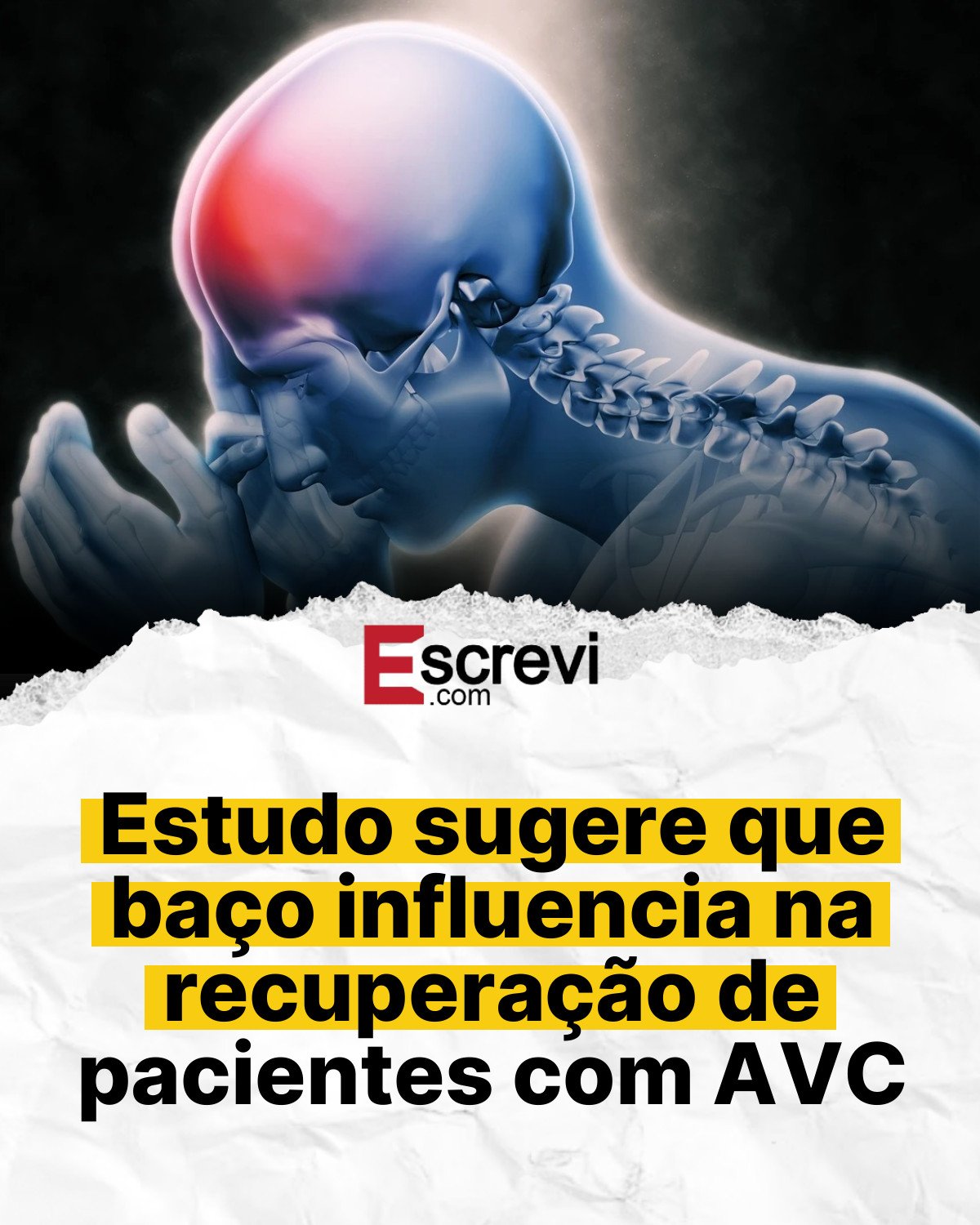 Estudo sugere que baço influencia na recuperação de pacientes com AVC card branco