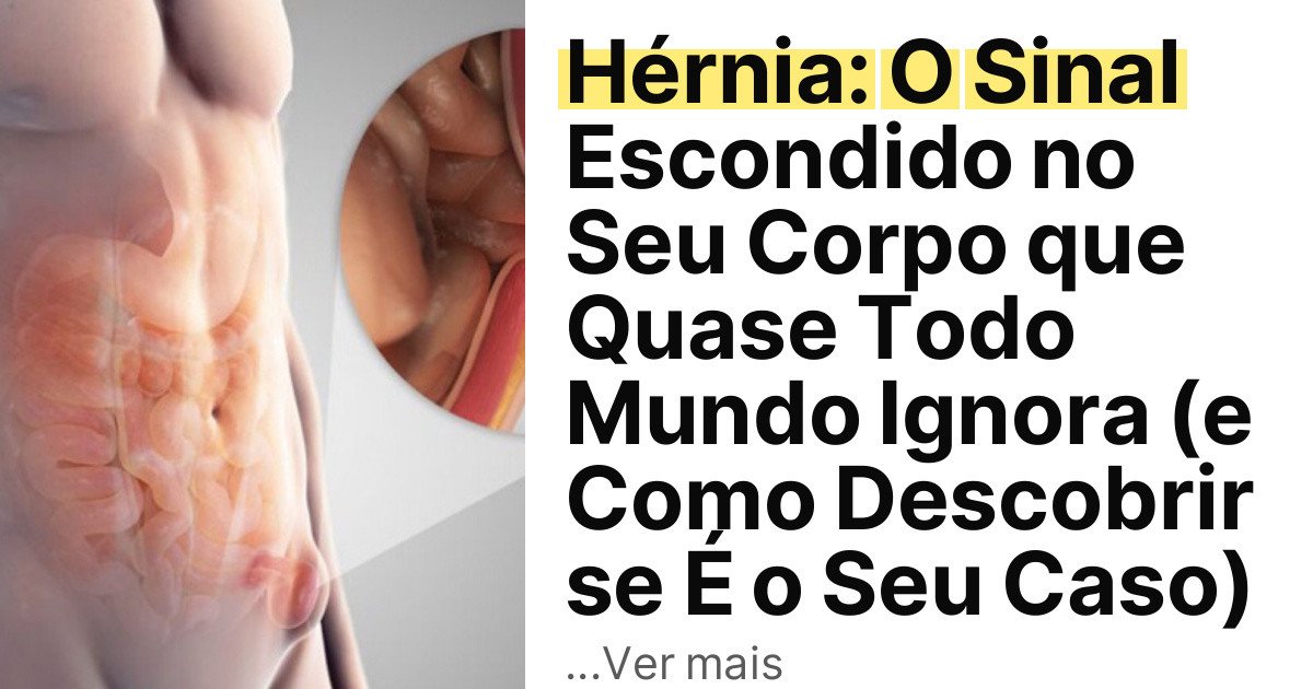 Hérnia: O Sinal Escondido no Seu Corpo que Quase Todo Mundo Ignora (e Como Descobrir se É o Seu Caso) imagem principal