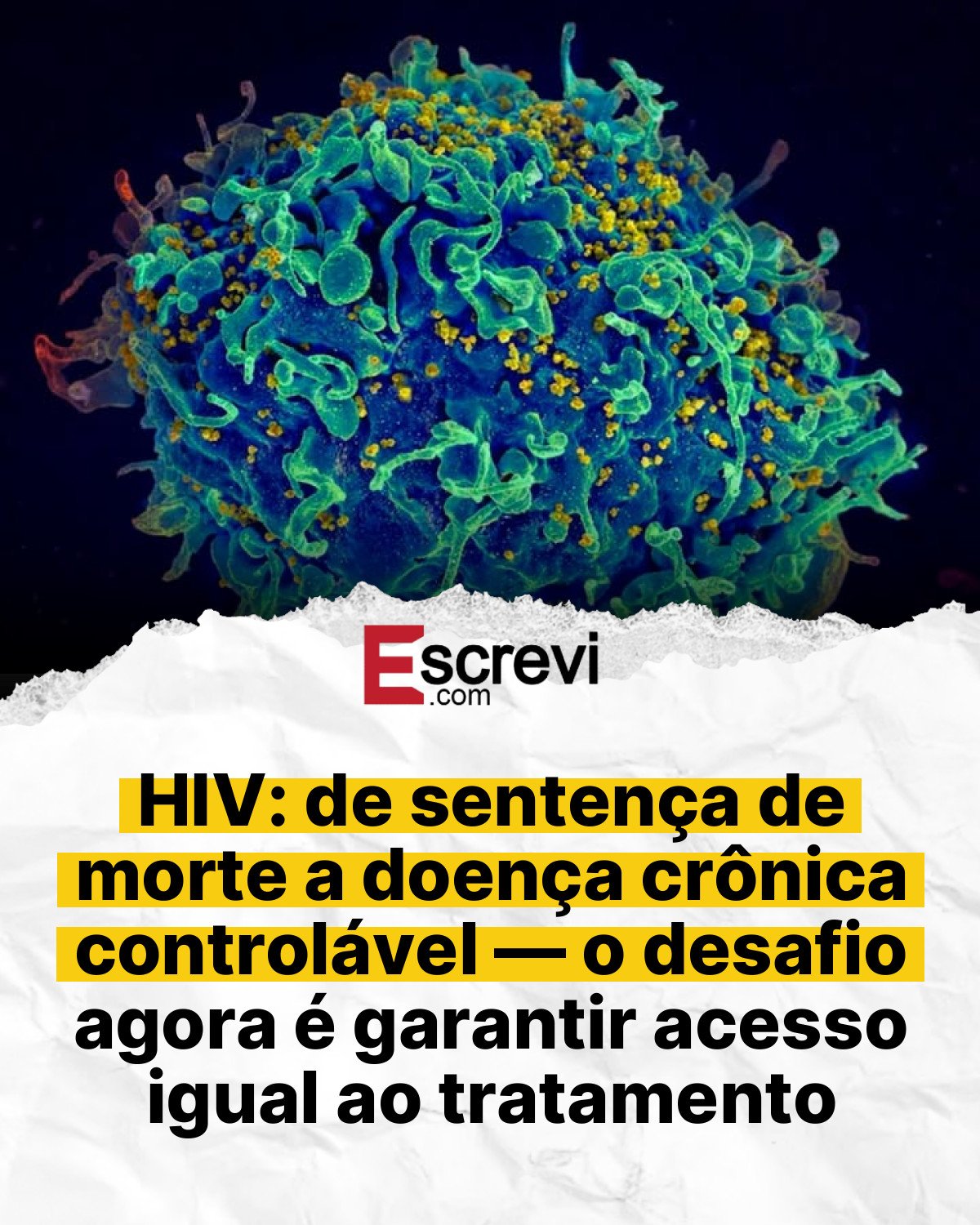 HIV: de sentença de morte a doença crônica controlável — o desafio agora é garantir acesso igual ao tratamento card branco