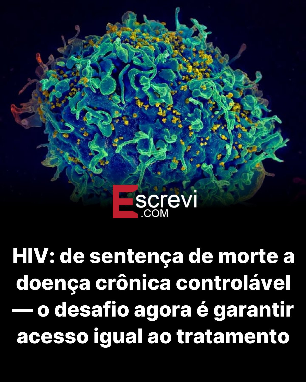 HIV: de sentença de morte a doença crônica controlável — o desafio agora é garantir acesso igual ao tratamento card preto