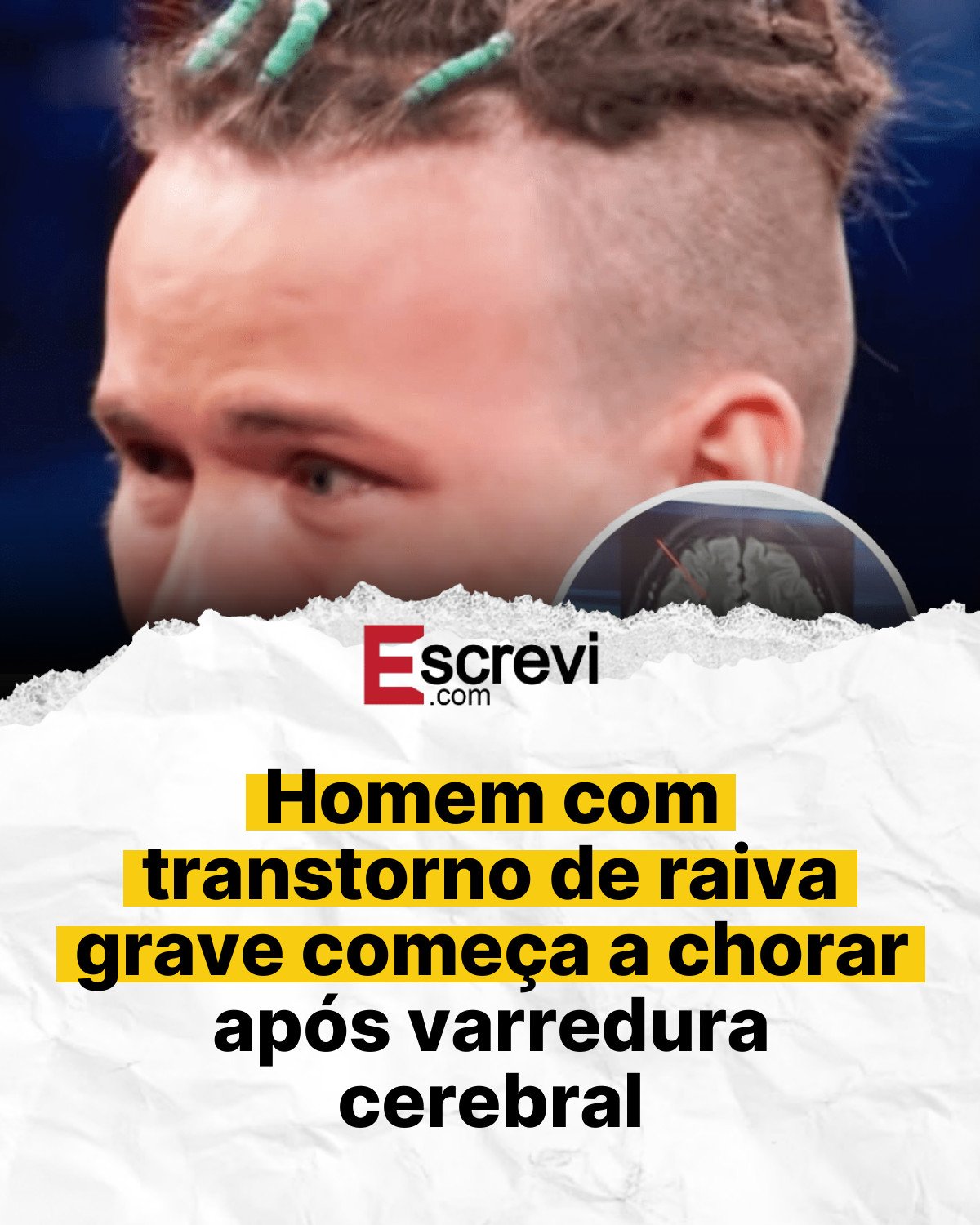Homem com transtorno de raiva grave começa a chorar após varredura cerebral card branco