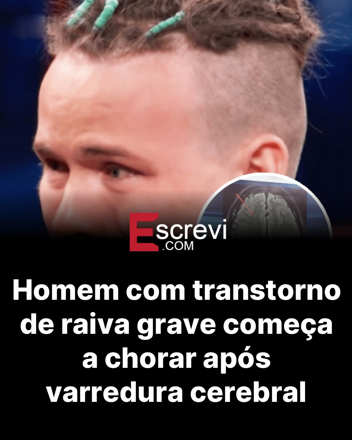 Homem com transtorno de raiva grave começa a chorar após varredura cerebral card preto