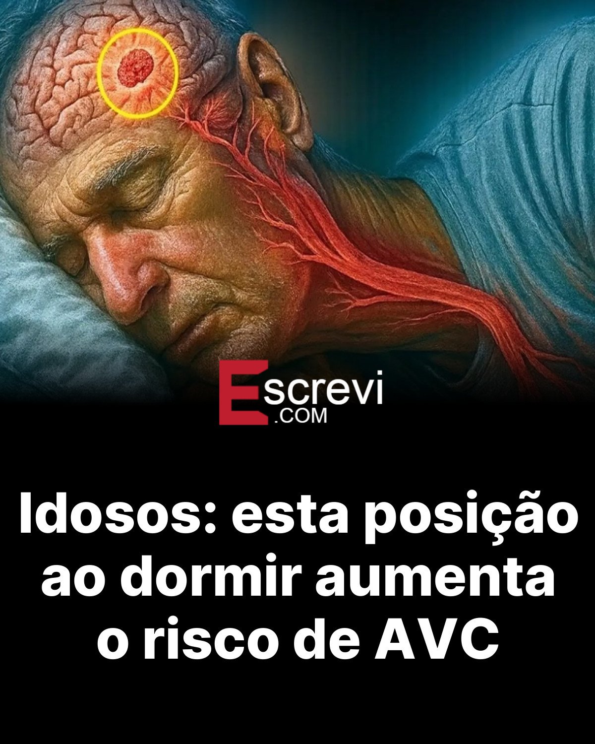 Idosos: esta posição ao dormir aumenta o risco de AVC card preto
