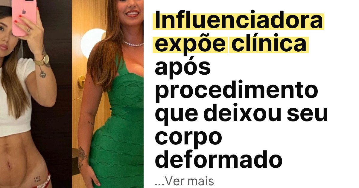 Influenciadora expõe clínica após procedimento que deixou seu corpo deformado imagem principal