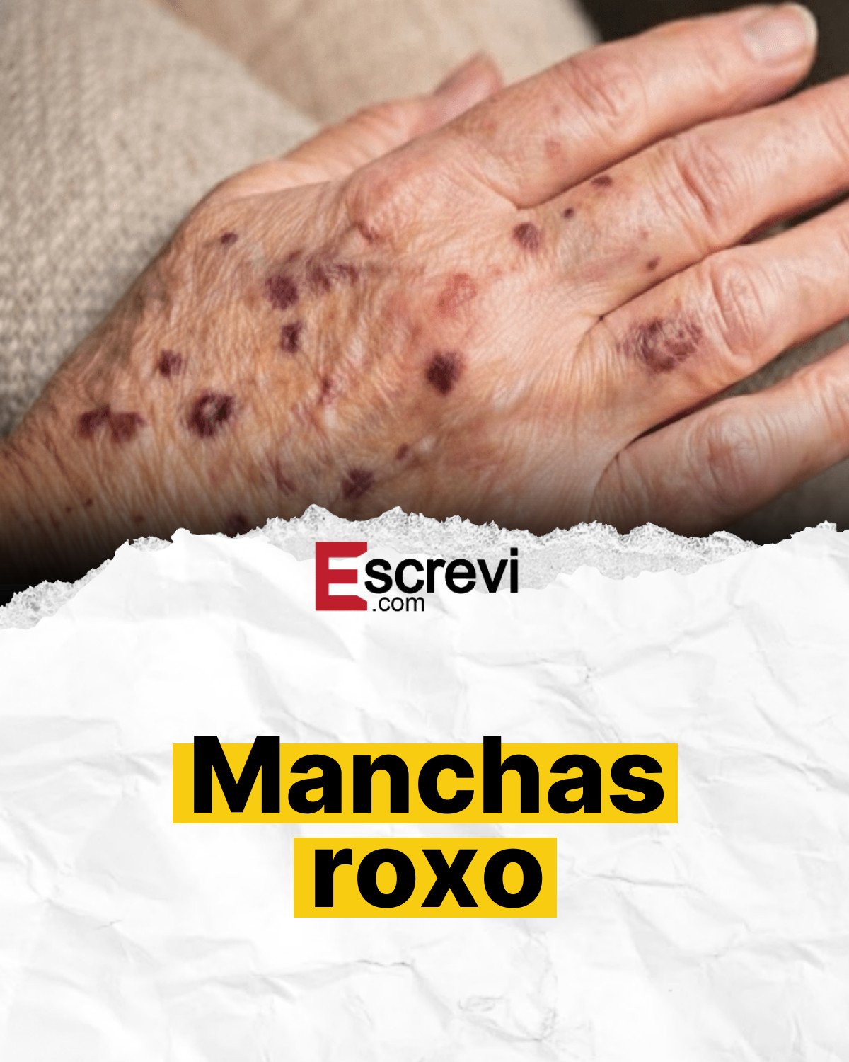 Manchas roxo card branco