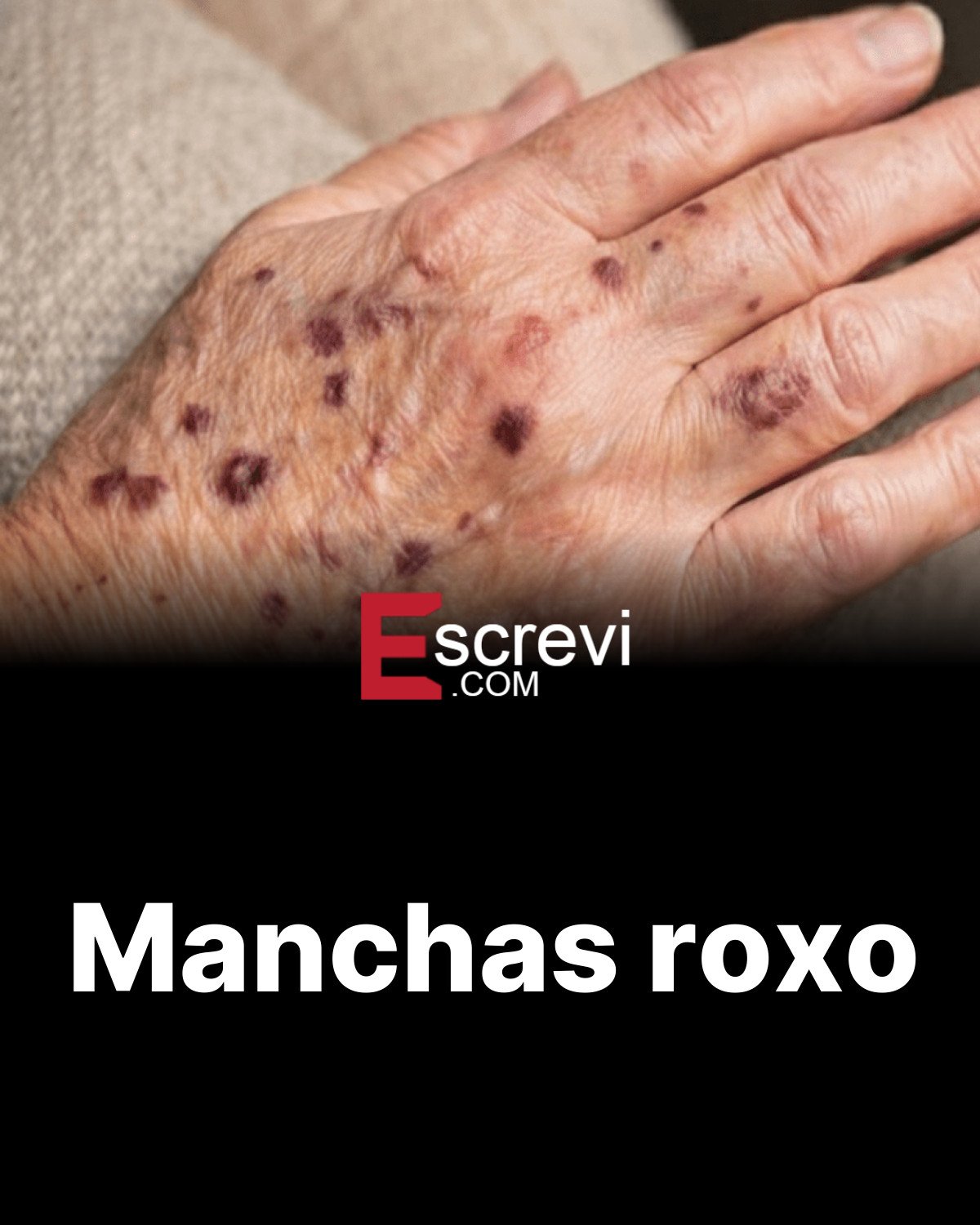 Manchas roxo card preto