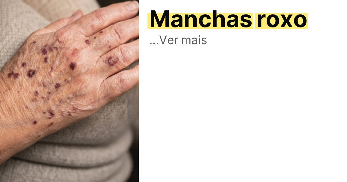 Manchas roxo imagem principal