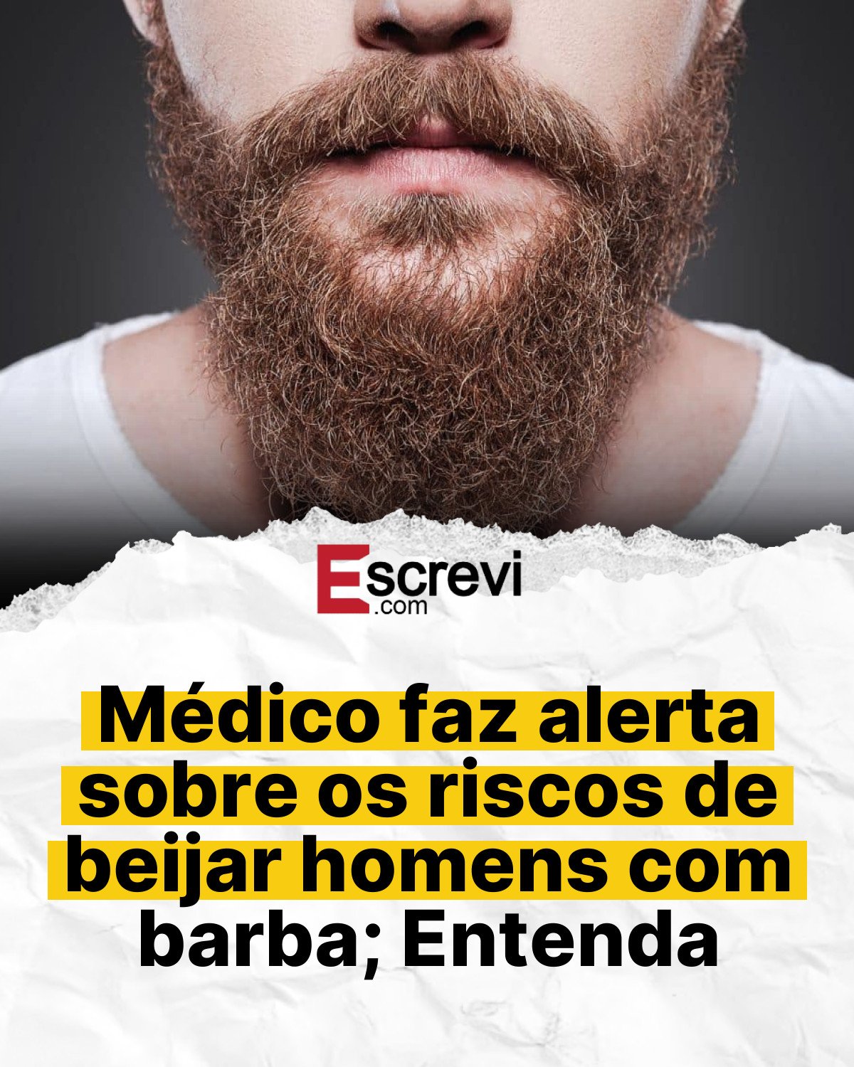Médico faz alerta sobre os riscos de beijar homens com barba; Entenda card branco