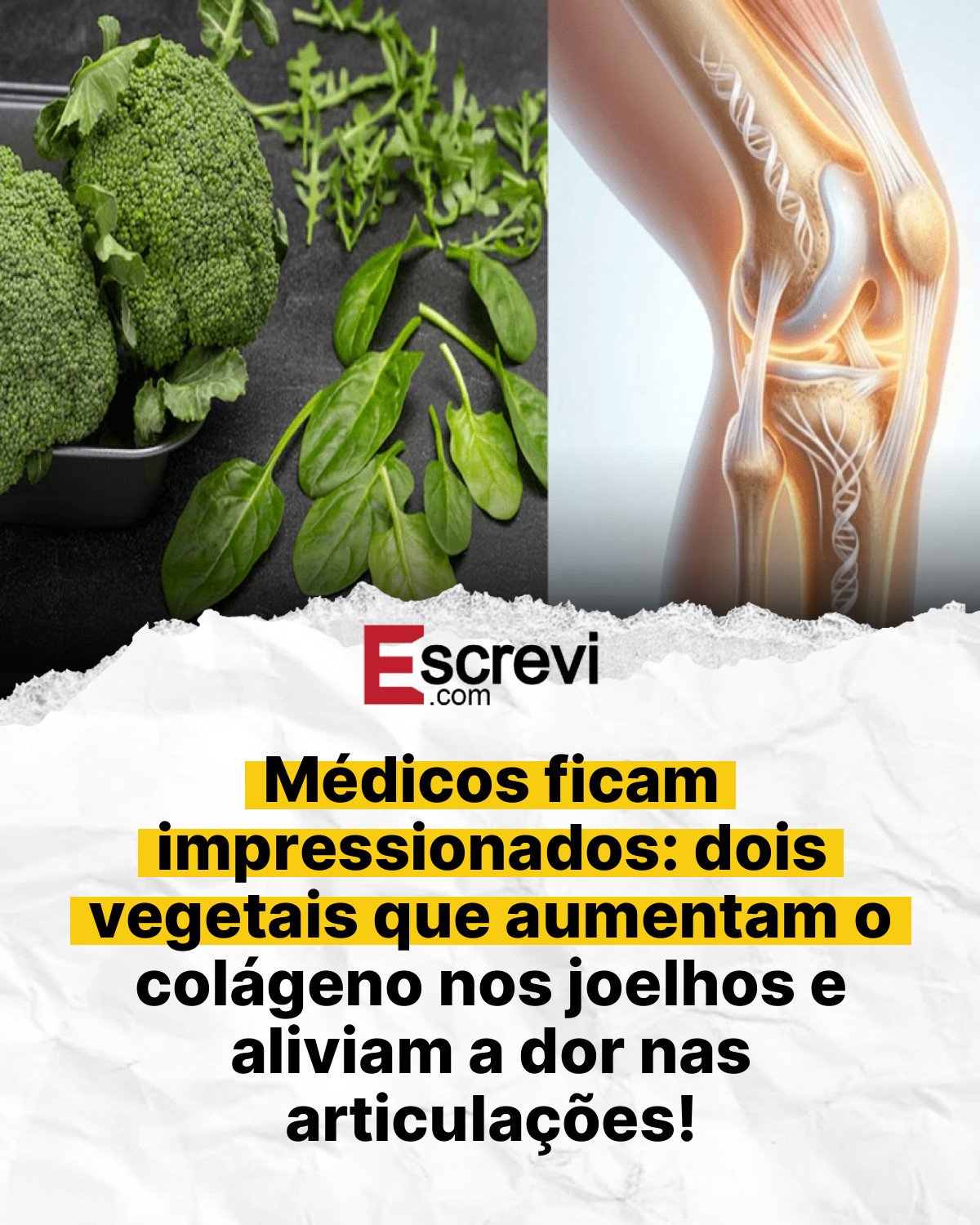 Médicos ficam impressionados: dois vegetais que aumentam o colágeno nos joelhos e aliviam a dor nas articulações! card branco