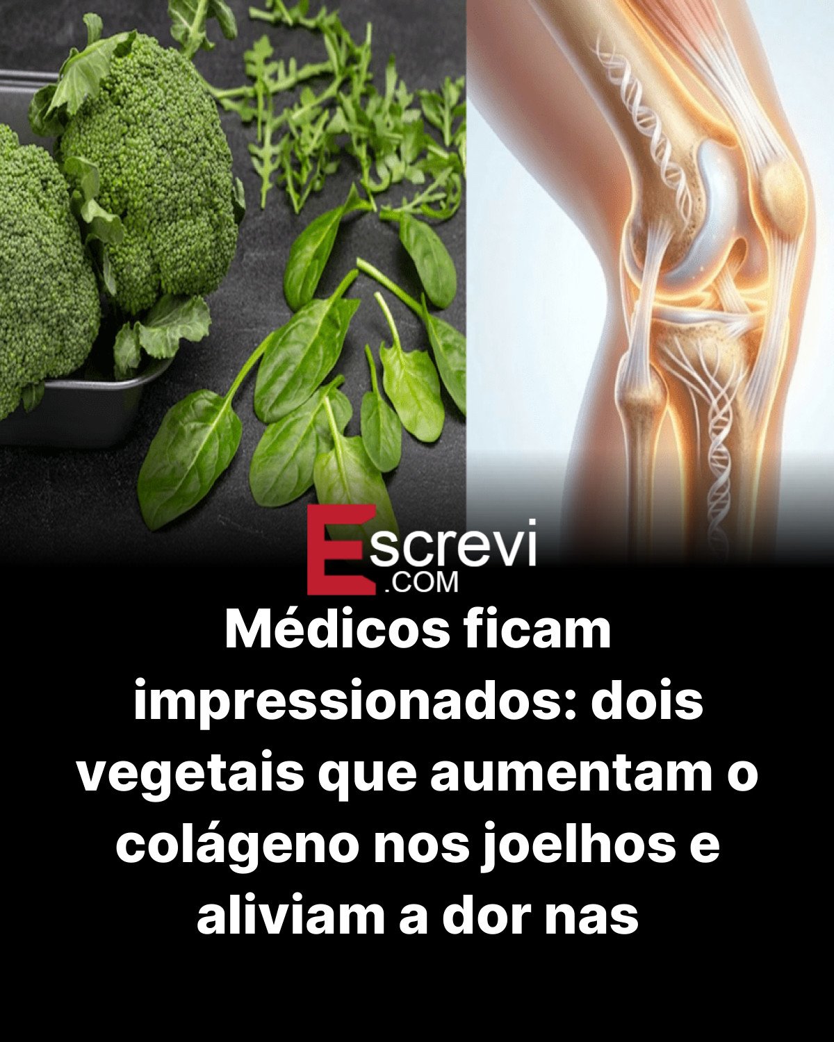 Médicos ficam impressionados: dois vegetais que aumentam o colágeno nos joelhos e aliviam a dor nas articulações! card preto