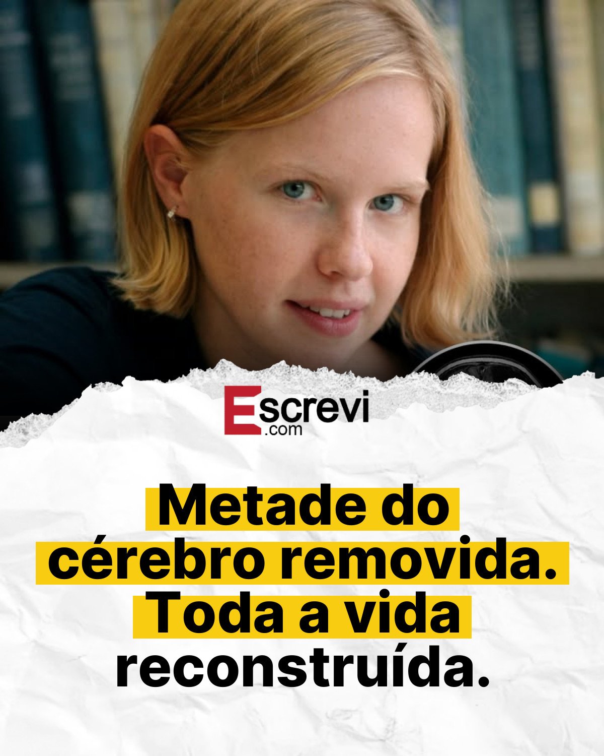 Metade do cérebro removida. Toda a vida reconstruída. card branco