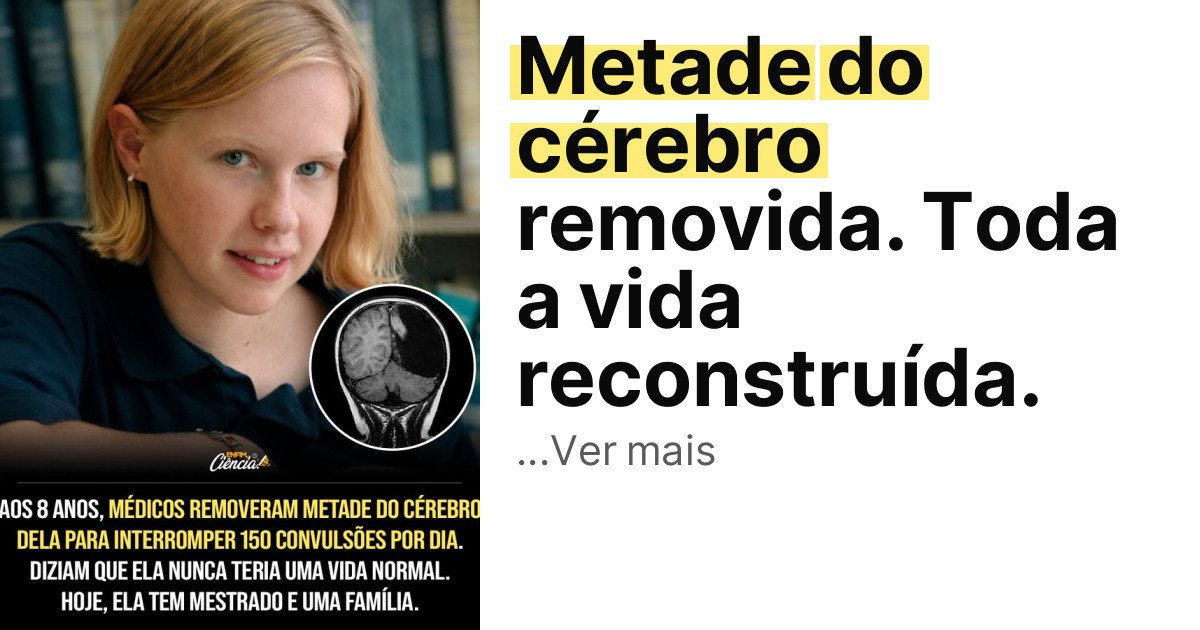 Metade do cérebro removida. Toda a vida reconstruída. imagem principal