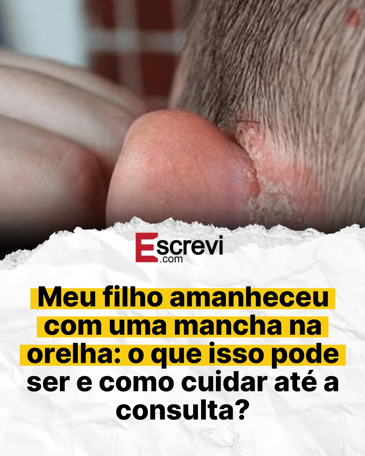 Meu filho amanheceu com uma mancha na orelha: o que isso pode ser e como cuidar até a consulta? card branco