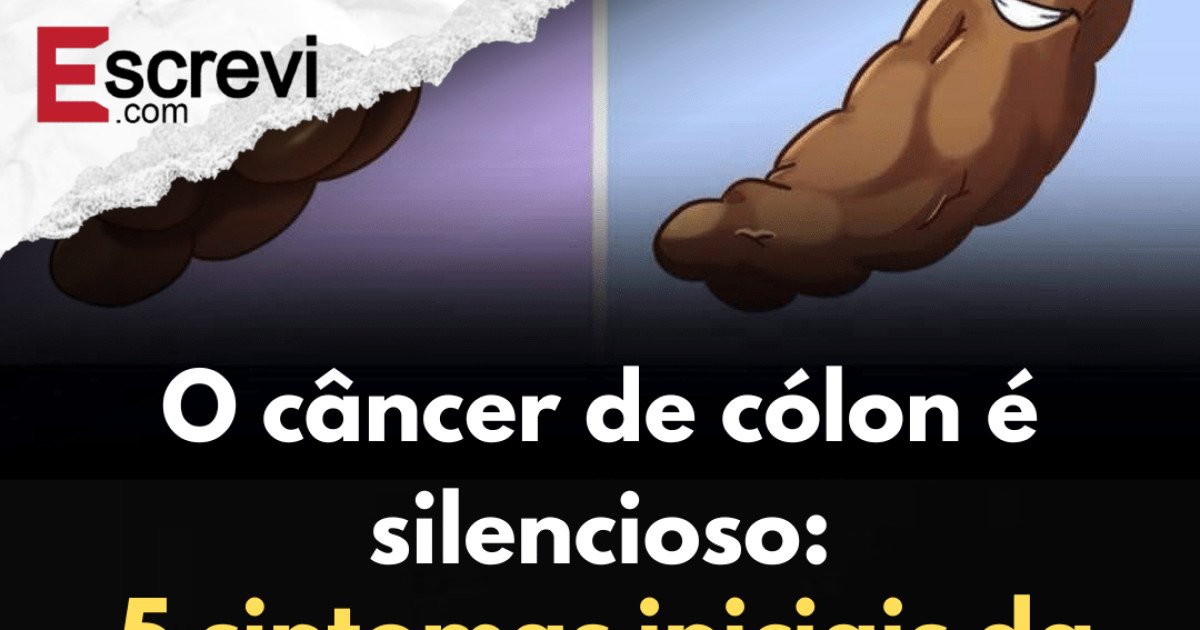 O câncer de cólon é silencioso: 5 sintomas iniciais da doença imagem principal