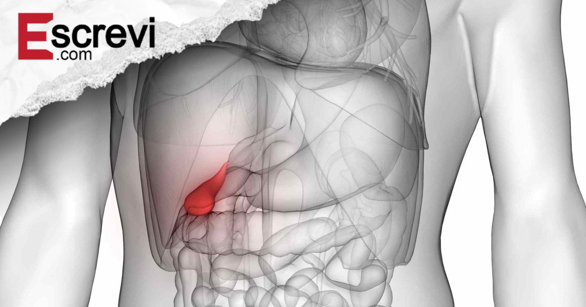 O que acontece após a remoção da vesícula biliar e 3 riscos para observar imagem principal