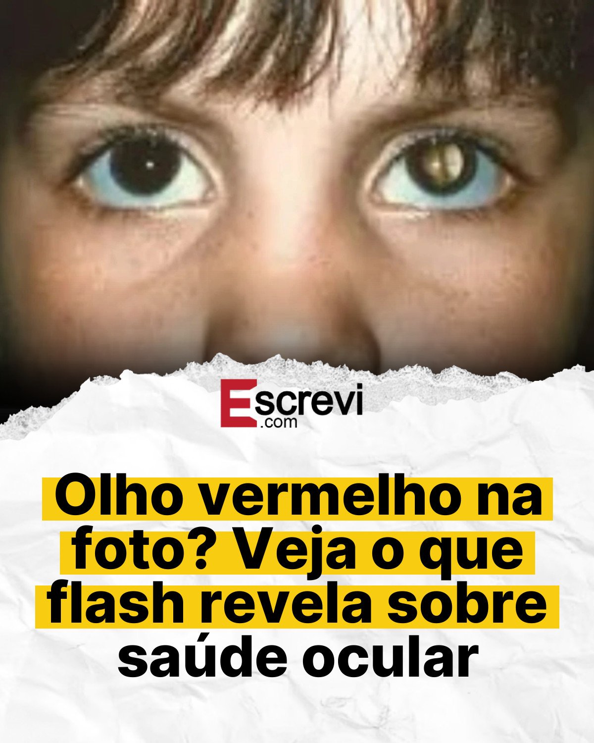 Olho vermelho na foto? Veja o que flash revela sobre saúde ocular card branco