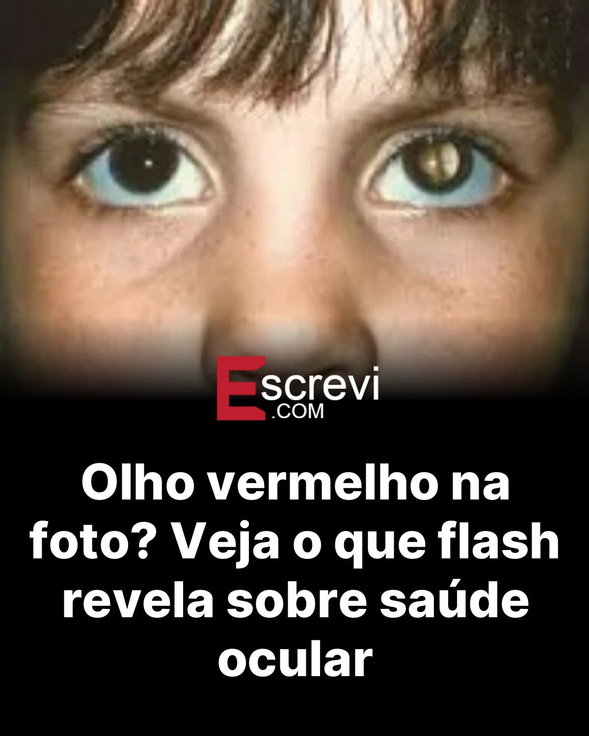 Olho vermelho na foto? Veja o que flash revela sobre saúde ocular card preto
