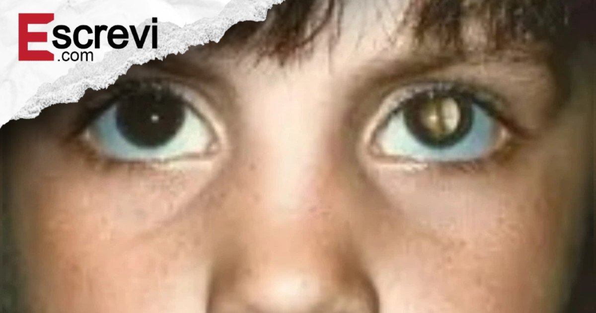 Olho vermelho na foto? Veja o que flash revela sobre saúde ocular imagem principal