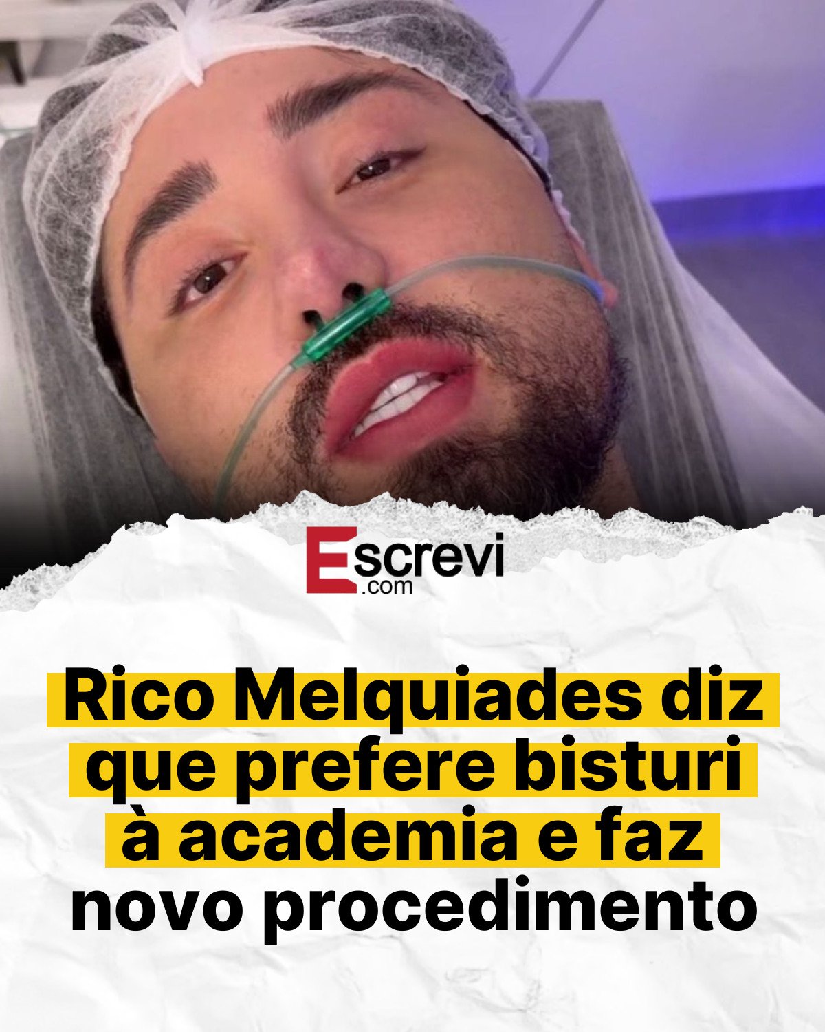 Rico Melquiades diz que prefere bisturi à academia e faz novo procedimento card branco