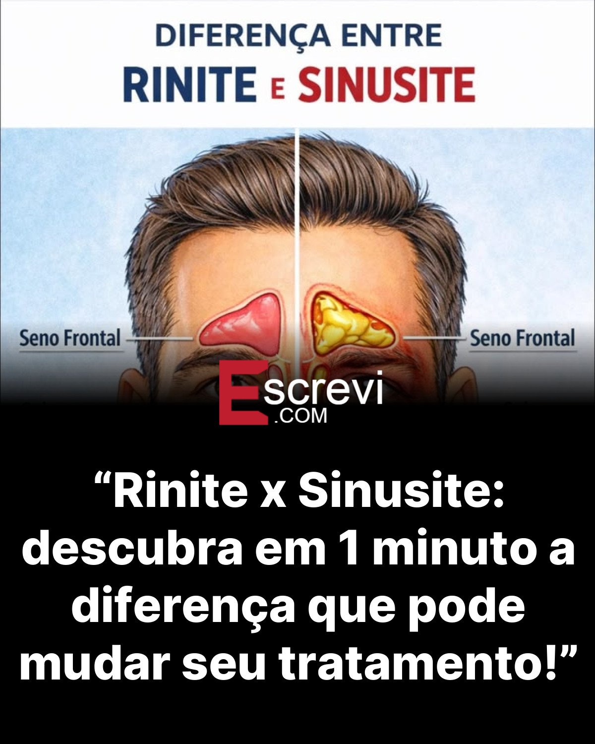 “Rinite x Sinusite: descubra em 1 minuto a diferença que pode mudar seu tratamento!” card preto