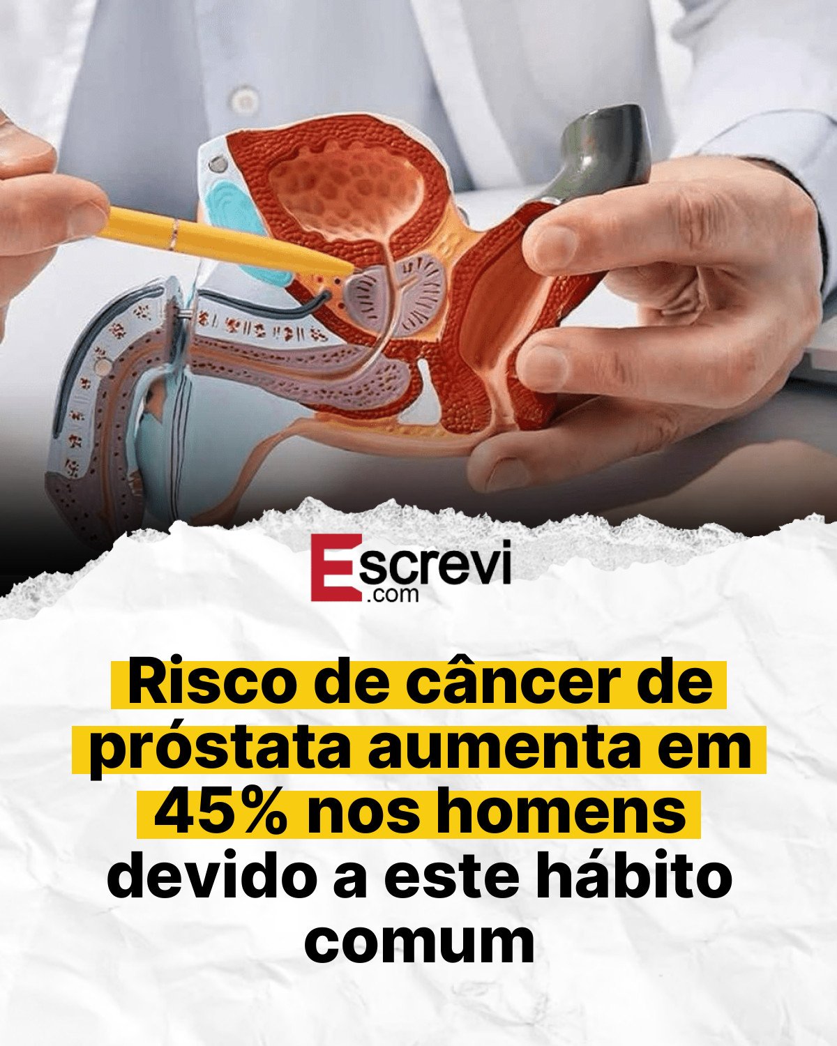 Risco de câncer de próstata aumenta em 45% nos homens devido a este hábito comum card branco