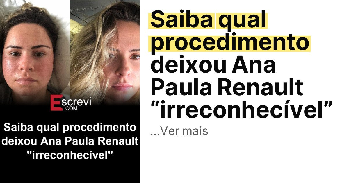 Saiba qual procedimento deixou Ana Paula Renault “irreconhecível” imagem principal