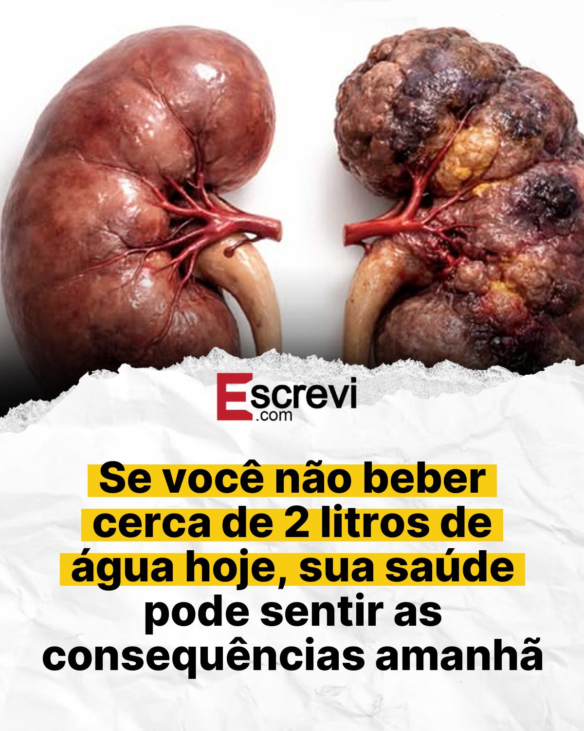 Se você não beber cerca de 2 litros de água hoje, sua saúde pode sentir as consequências amanhã card branco