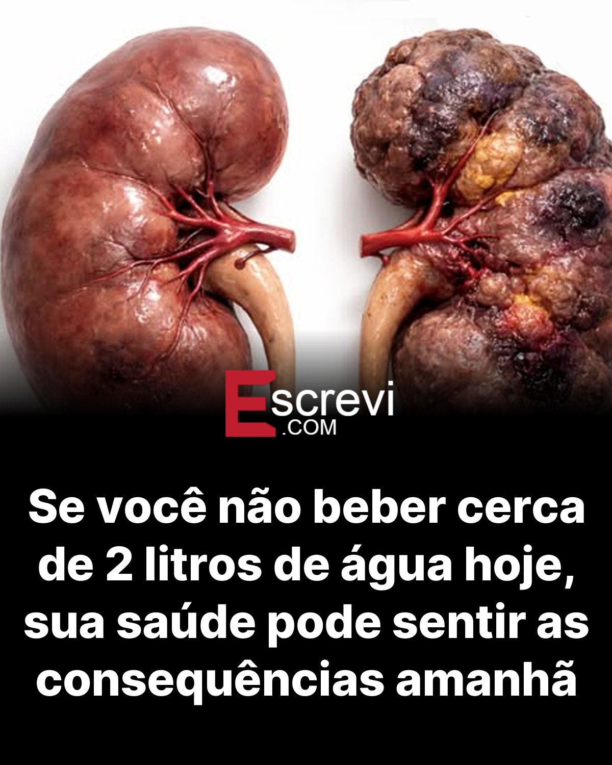 Se você não beber cerca de 2 litros de água hoje, sua saúde pode sentir as consequências amanhã card preto