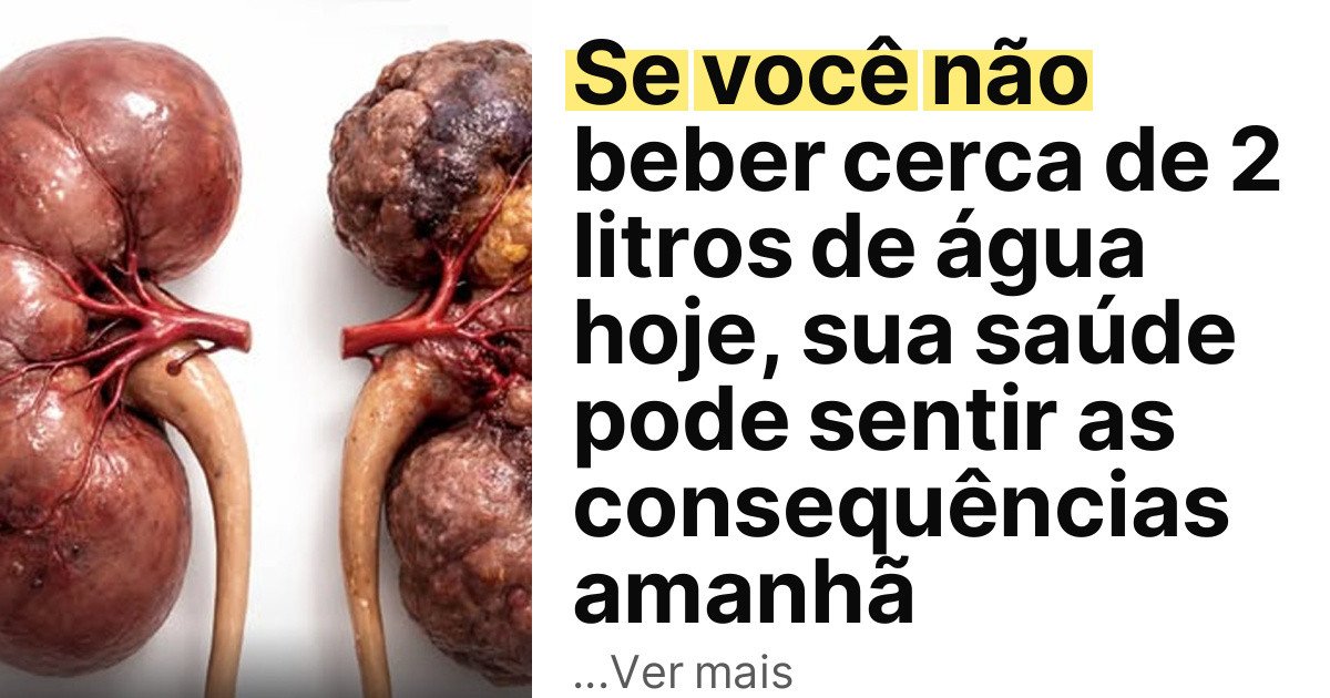 Se você não beber cerca de 2 litros de água hoje, sua saúde pode sentir as consequências amanhã imagem principal
