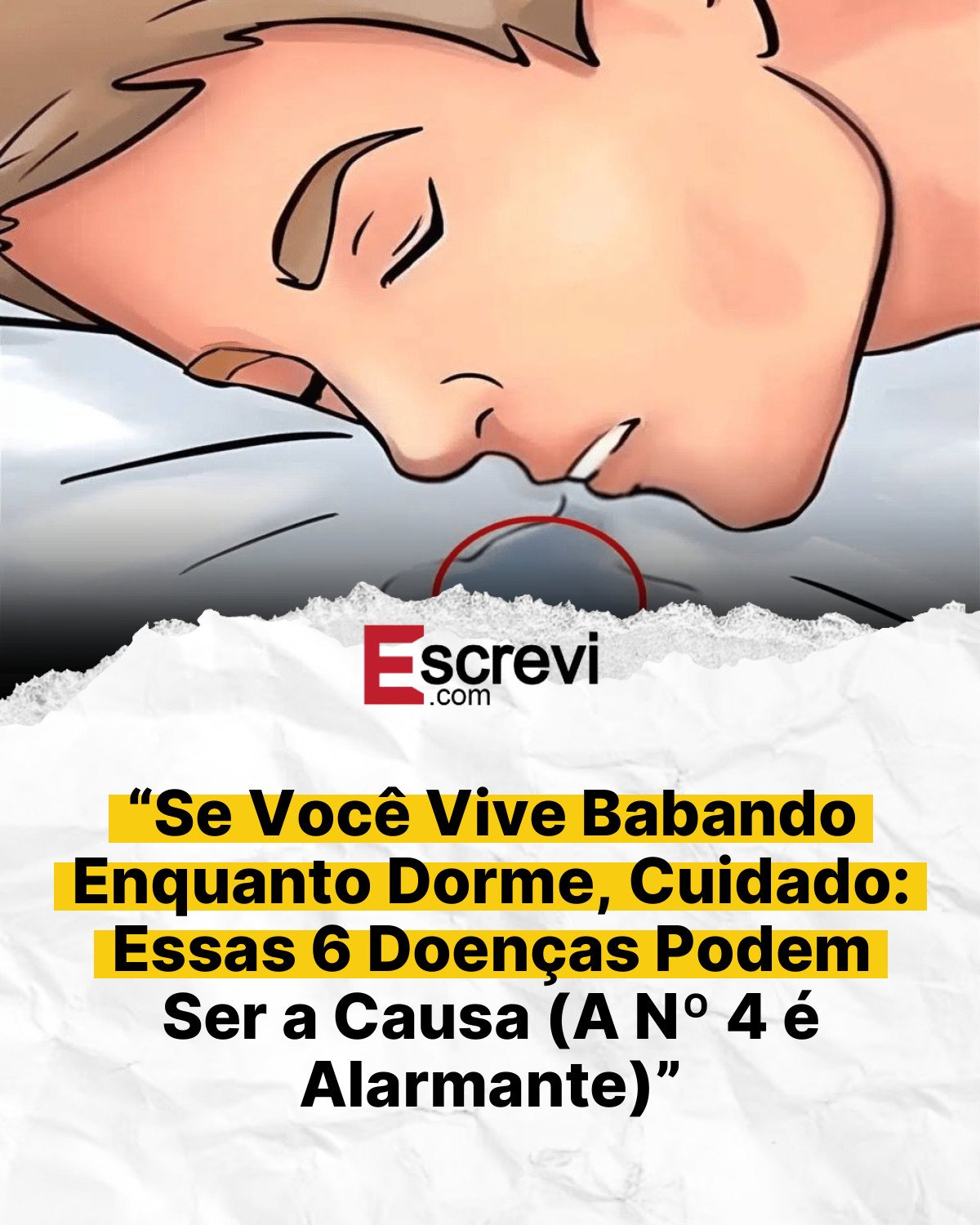 “Se Você Vive Babando Enquanto Dorme, Cuidado: Essas 6 Doenças Podem Ser a Causa (A Nº 4 é Alarmante)” card branco