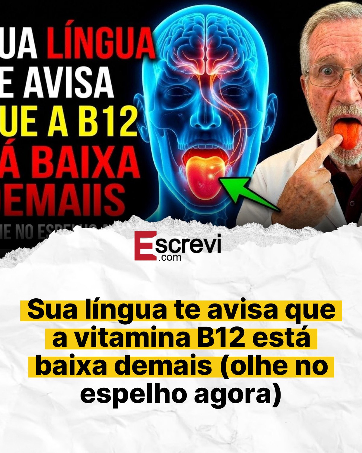 Sua língua te avisa que a vitamina B12 está baixa demais (olhe no espelho agora) card branco