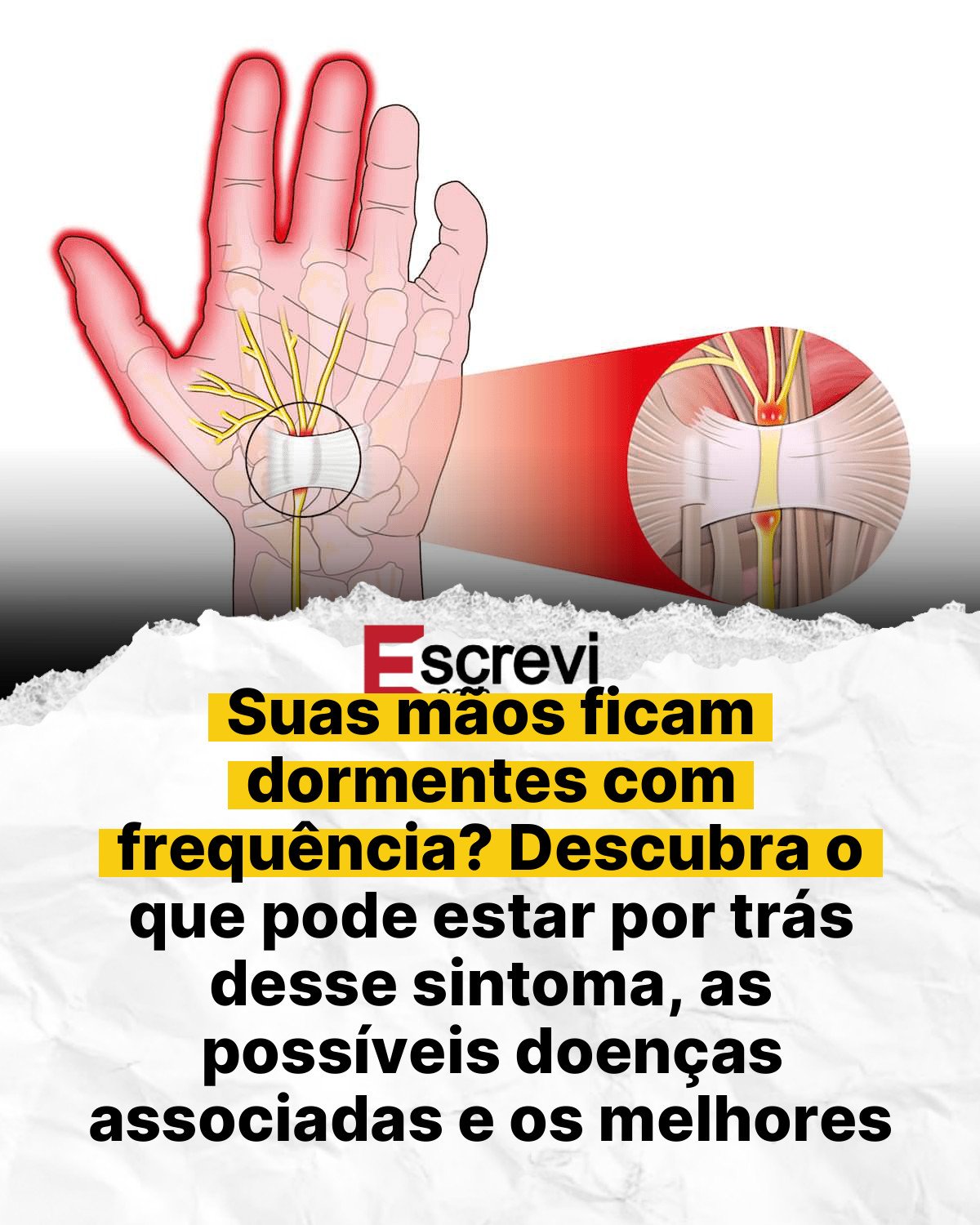 Suas mãos ficam dormentes com frequência? Descubra o que pode estar por trás desse sintoma, as possíveis doenças associadas e os melhores remédios naturais card branco