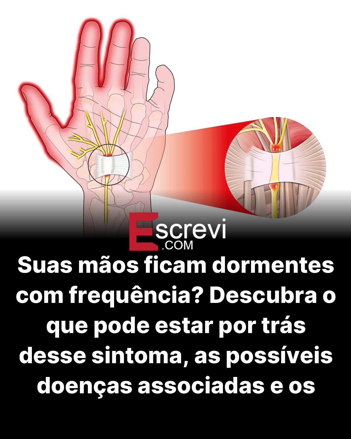 Suas mãos ficam dormentes com frequência? Descubra o que pode estar por trás desse sintoma, as possíveis doenças associadas e os melhores remédios naturais card preto